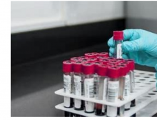 CORSO:I Laboratori Medici e il Regolamento 746/2017: novità in merito ai Dispositivi Medico – Diagnostici in vitro IVDR